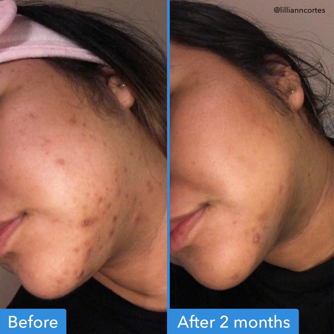discoloration-correcting-serum-p1 zb_p.jpg